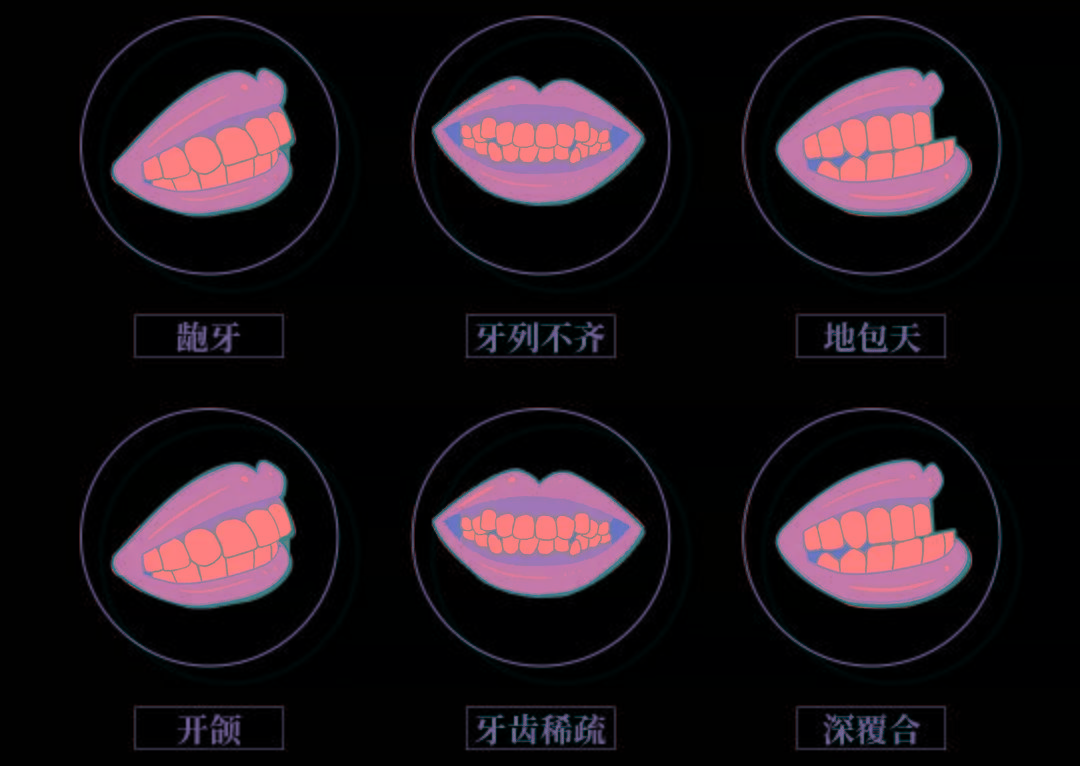 钢牙|深扒牙齿矫正「内幕」，明星同款隐适美半价就能享？！