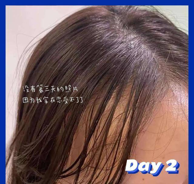 头皮|超难用的洗发水避雷，你中招了吗？