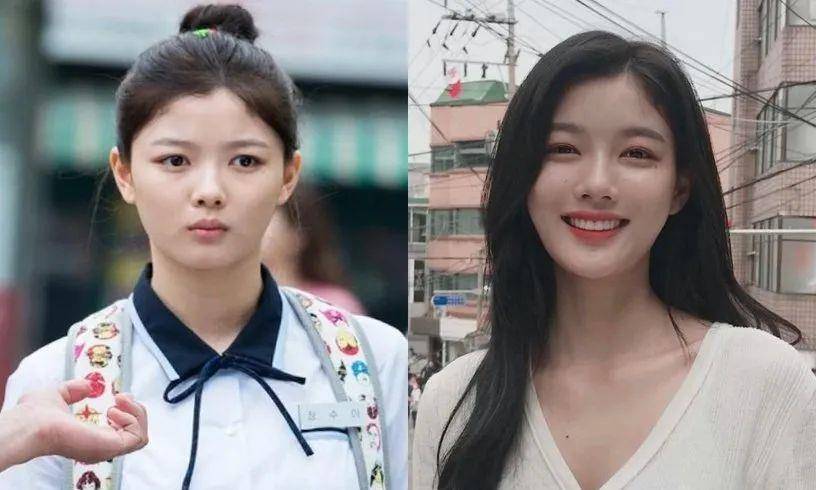 调整|赵露思调整发际线后显瘦10斤？提升颜值，拯救发际线小妙招来了！