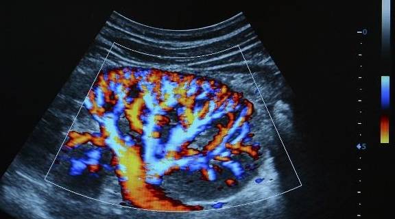 肾脏|为何“肾脏病”越来越多?提醒:3个指标得不到控制,会伤肾