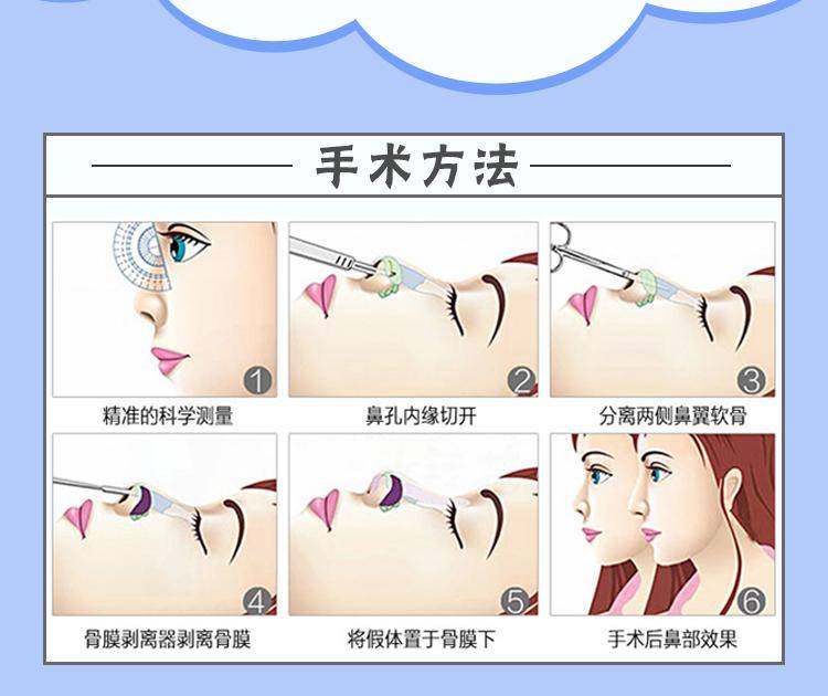 典范|常州曙光整形医院隆鼻专业吗 医美行业典范品牌