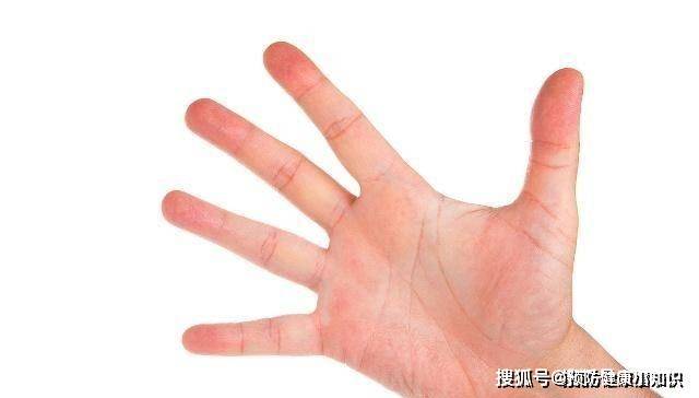 毒素|肝病是“拖”出来的？若有3种异常，多半是肝在向你“哭诉”