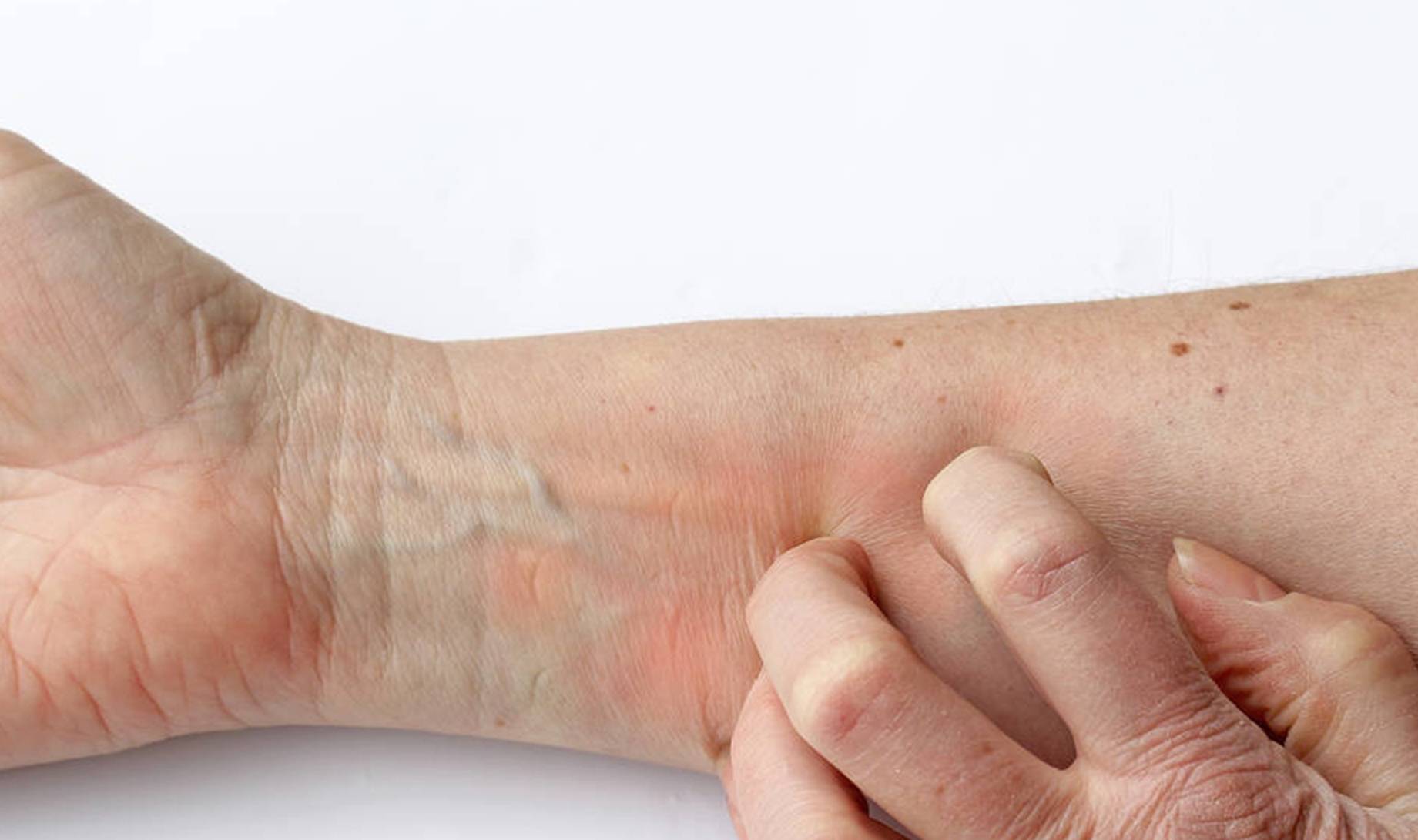 并发症|身上若2处“发痒”，很遗憾告诉你：血糖早已超标，别后知后觉