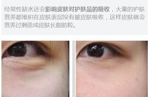 清洁|孕期还敢用清洁面膜？深扒鲜为人知的宝藏面膜品牌，孕妇可用