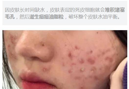 清洁|孕期还敢用清洁面膜？深扒鲜为人知的宝藏面膜品牌，孕妇可用