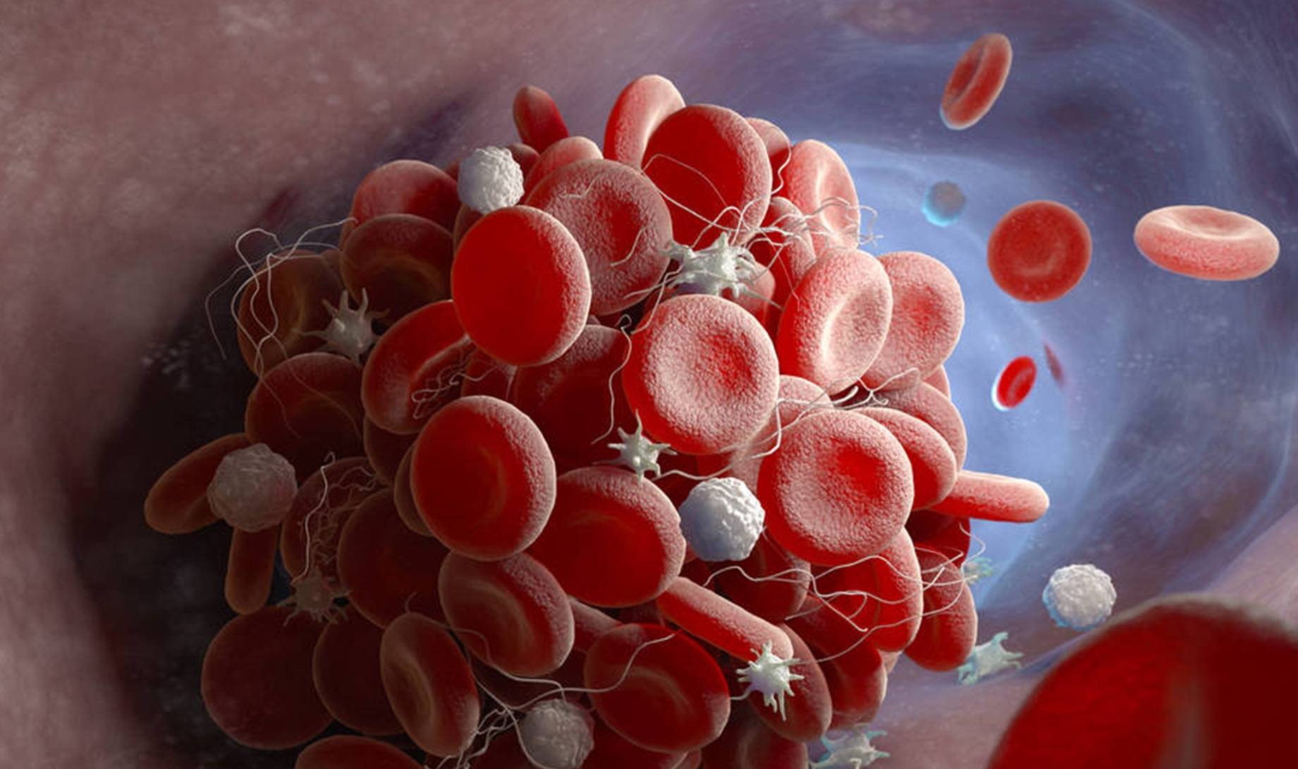 眼睛|血糖超标，“眼睛”先知道！若没有出现4异常，祝贺，血糖很稳定