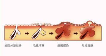 女神|有种尴尬叫“卡粉”！女明星底妆“翻车”合集，这是涂了多少层？