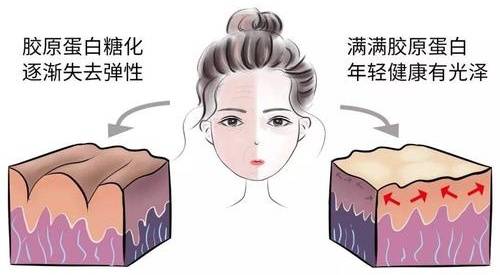 自律|秋冬换季如何管理好皮肤