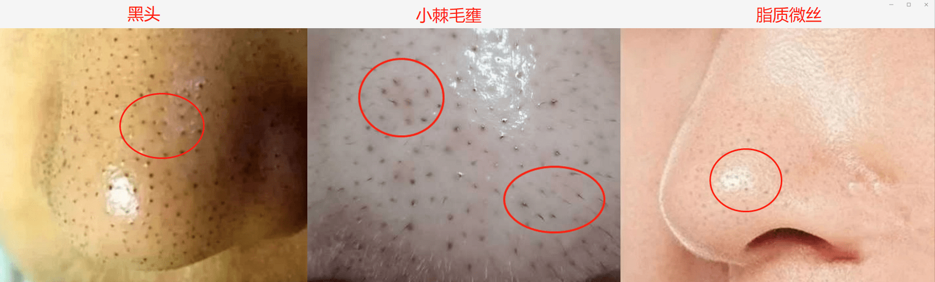 痘痘|如何养出女明星那样细腻的好皮肤？最关键是做对这7点，全教给你！