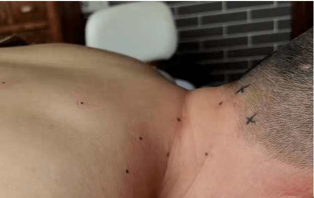 全身|眩晕症诊治——中西医殊途同归