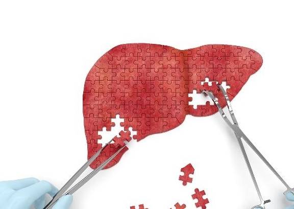 肝脏|乙肝身上出现红痣是怎么回事？这些知识，需要了解清楚