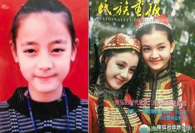 角色|这6个明星天然脸长得跟整容似的，这种痛苦和烦恼谁不想有？