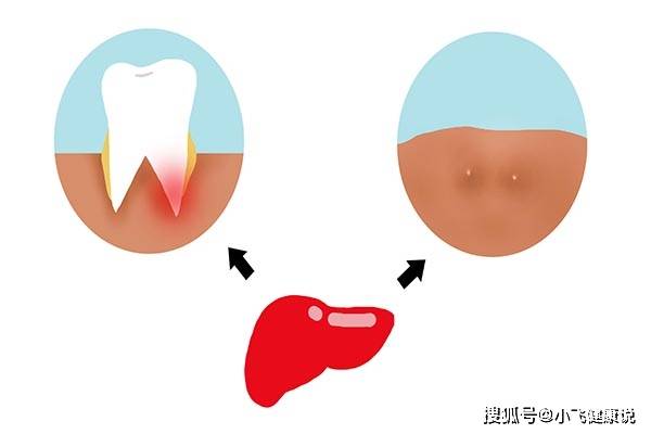 进行|家庭成员是乙肝患者,应该分桌就餐吗?肝病科专家给出了中肯建议