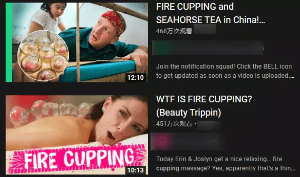 文化|这届老外，终于知道拔罐的秘密了？