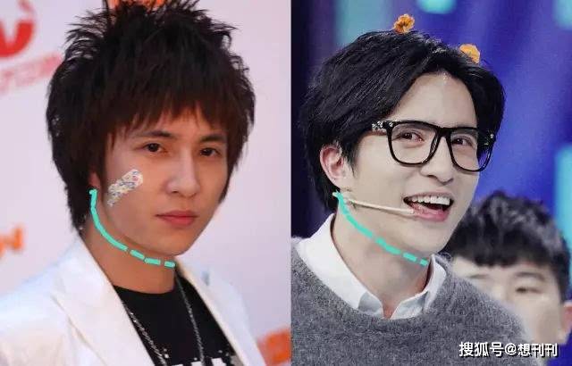综合|眼鼻综合买一送一？满屏都是欧双高鼻梁，不是亲生就是一个医生