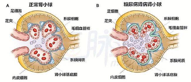 生理性|小便呈现橘红色 很可能是这些原因