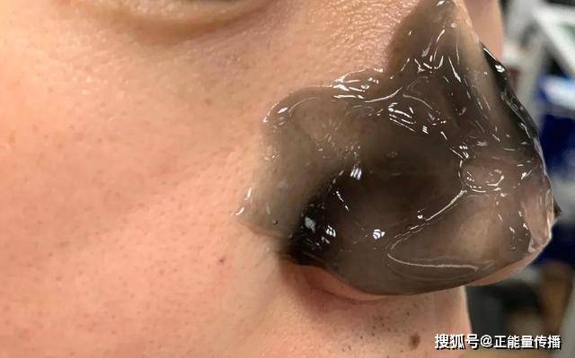 肝脏|肝脏有癌，身体先知？若身体出现5种“异常”，建议预防癌症