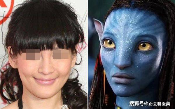 一针|颧骨高？一针“缩骨”，变成“黄晓明”？