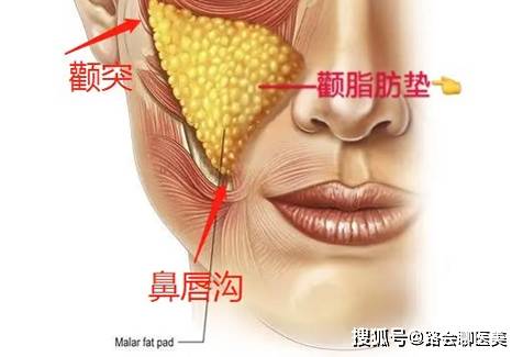 一针|颧骨高？一针“缩骨”，变成“黄晓明”？