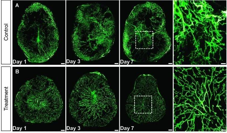 3D成像：肿瘤及病理组织中的应用