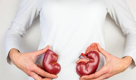 治疗|IgA肾病你了解多少？能彻底治愈吗？提醒：转阴并不是最佳疗效！