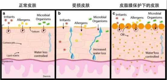 方法|皮肤干痒是缺水吗？教你正确补水护肤方法，恢复水嫩嫩的脸