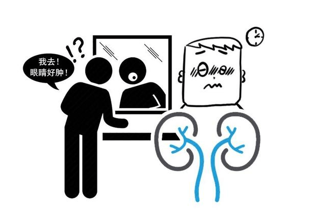 综合征|肾病综合症能活多久？医生坦白：生存长短，要看这2个因素