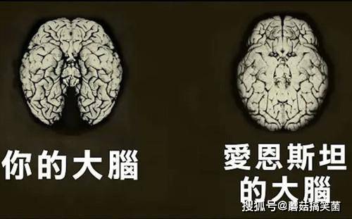 愛因斯坦的大腦有什麼特別之處？科學家經過研究後找到了答案 科技 第4張