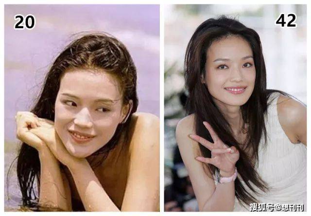 下巴|那些一刀切削骨的明星还好吗？后遗症一大堆，小方脸成最大赢家
