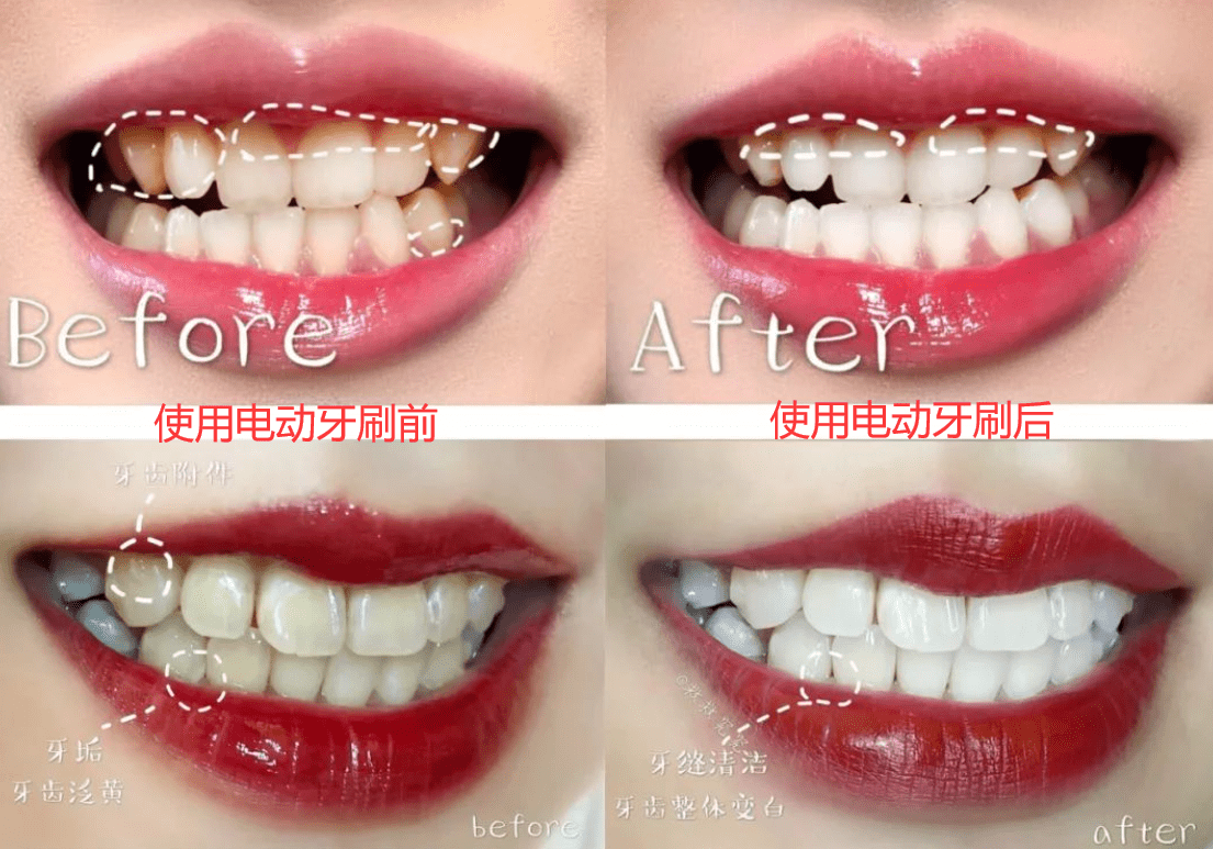 a3a2f39acd8d489c9afe89d9fb3cfa2f.png