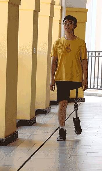 通常需要依靠多种机制来吸收自然冲击力,但是截肢者截肢之后残肢比