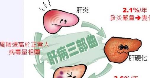 肝脏|假如你有乙肝，可能会问：肝硬化能“逆转”吗？听听医生怎么说！