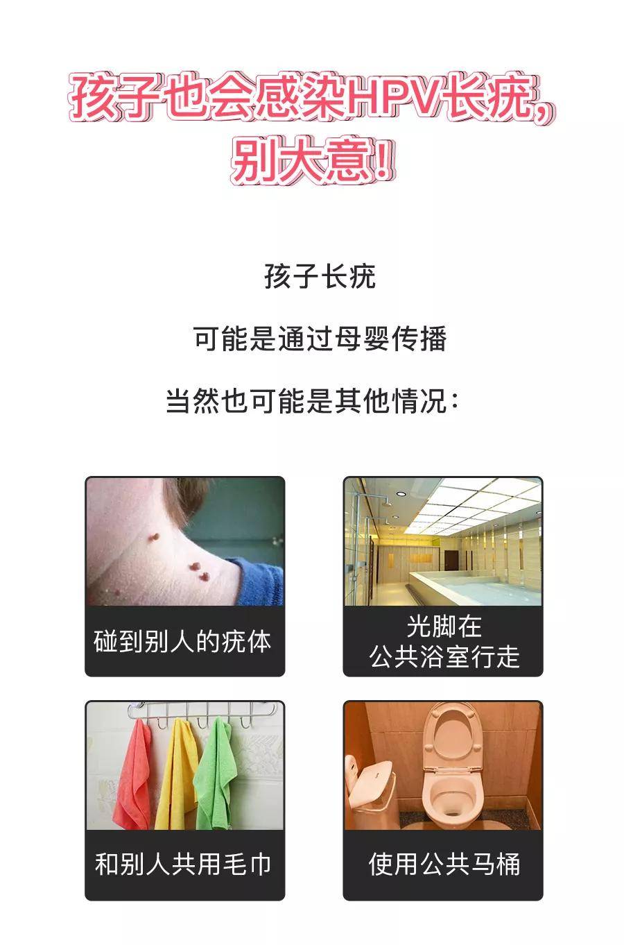 身上长瘊子是感染了HPV病毒!千万别做这件事,会传染给宝宝_疫苗