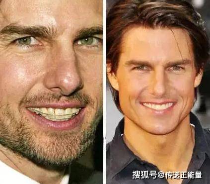 男性与女性的衰老时间不同?男性大约是50岁左右,女性是多少岁?