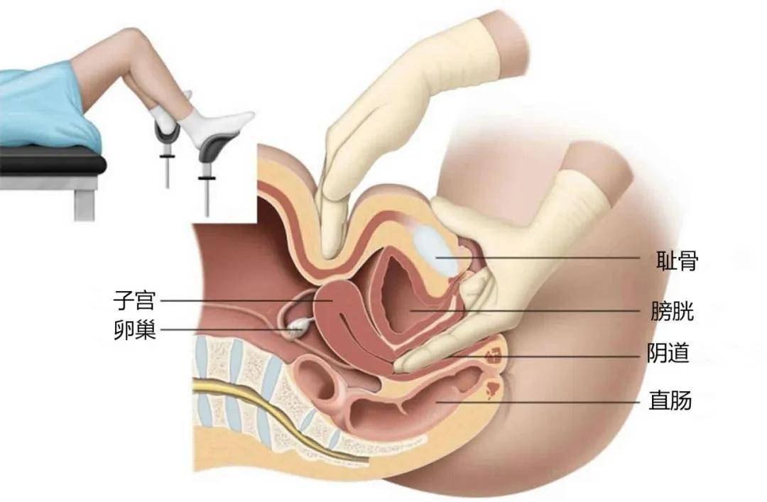 后壁|赤裸着张开腿的妇科检查，成女性「噩梦」！检查前一定要对医生说这句话