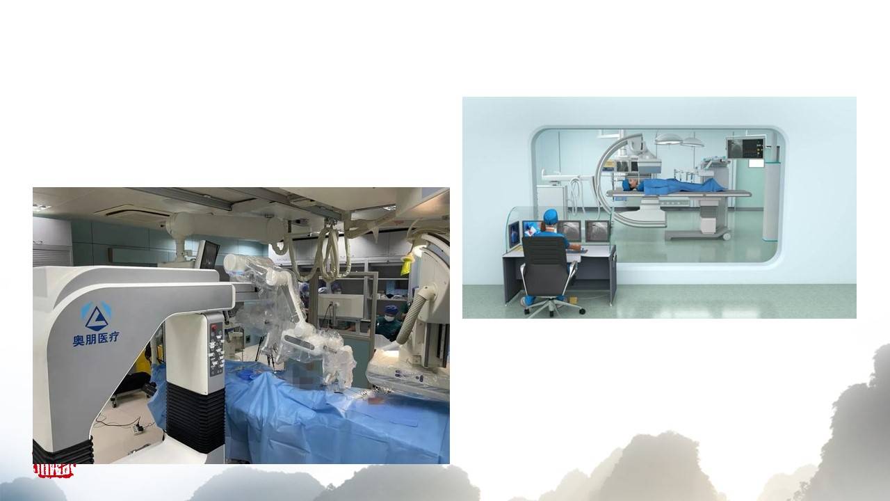 机器人|血管介入机器人的现状与展望