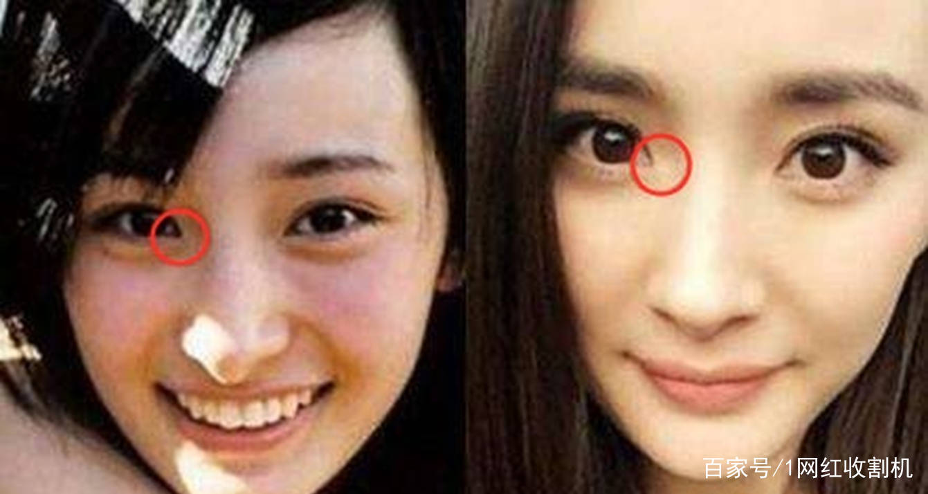 隆穹|太尴尬了!盘点8位明星“改头换面”后车祸现场,都是灾难(下)