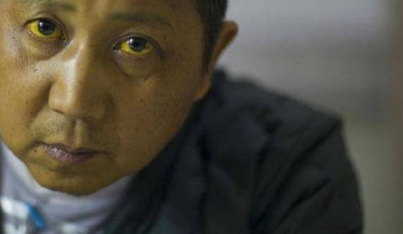 硝酸鹽|3種食物堪稱“爛肝王”，你若愛吃，肝功能越“弱”，勸你早忌口