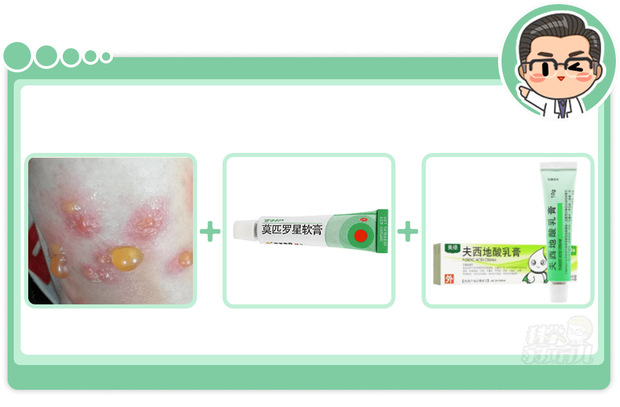 除虫菊|触目惊心！蚊子传染19006例登革热，秋季严防这种“毒蚊”！