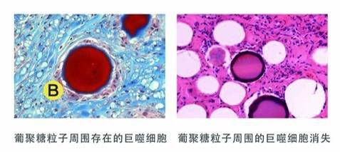 风口|再生医美新风口，心辰品牌如何引领再生材料新方向