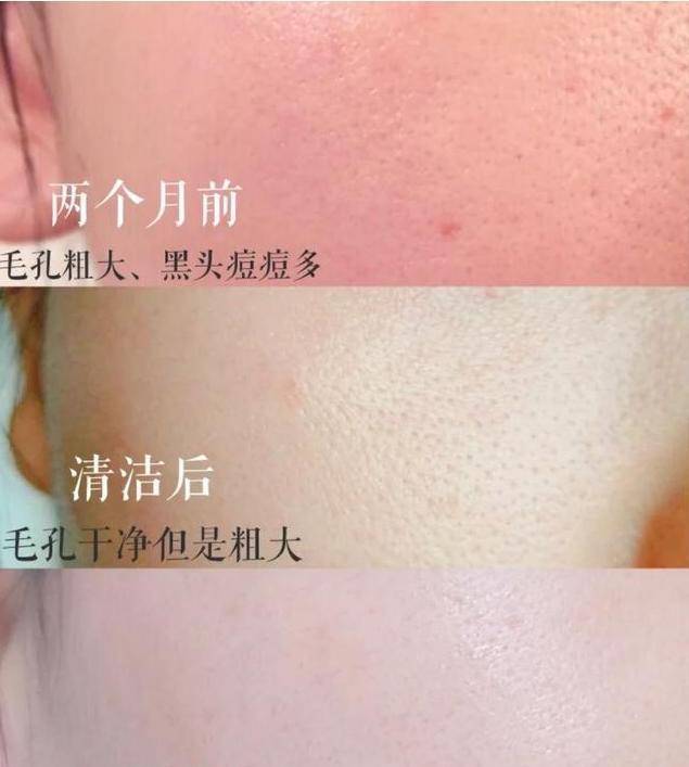 功能|宋智孝为美“全身换血”，护肤升级后皮肤更好，38岁像18岁少女