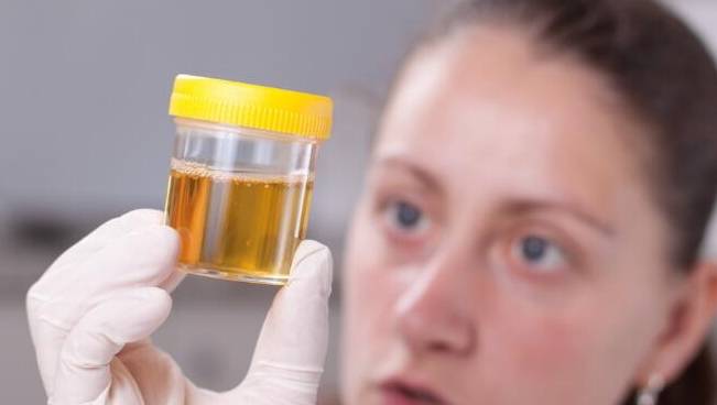 尿液|肾病好转，4项尿液指标会发信号，若都有先恭喜你