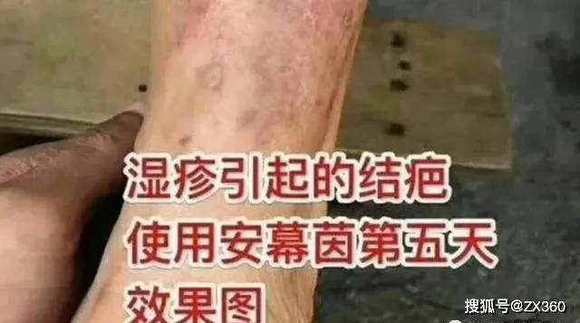 萱嘉生物因涉嫌传销被冻结1500万元 安幕茵虚假宣传(图19)