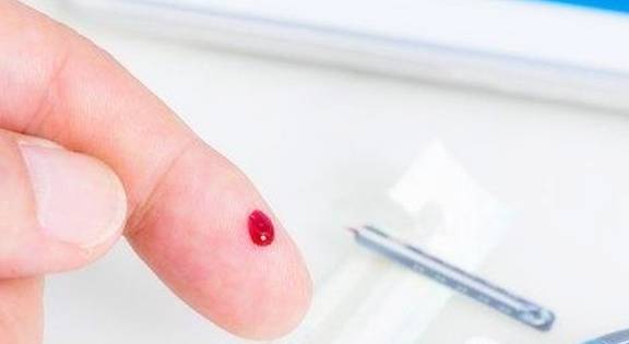 并发症|空腹血糖值9到10之间严重吗?你的理解真的对吗?看专家的理解