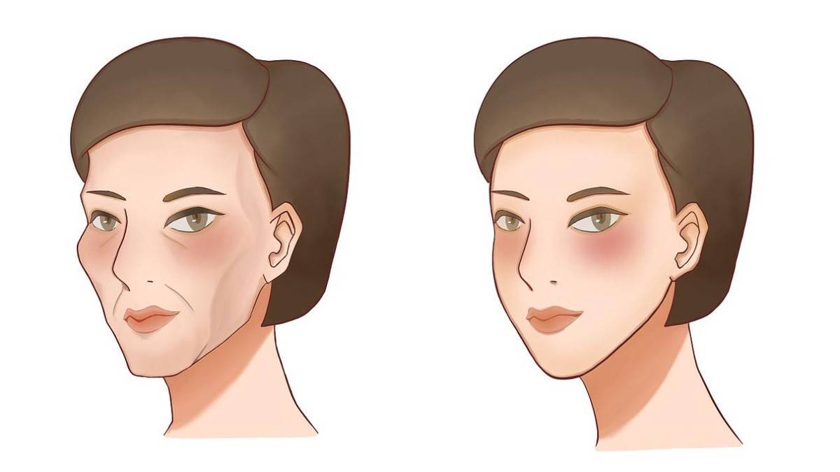 面部凹陷的女人面相 脸颊两侧凹陷的图片