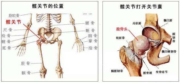 最伤股骨头的动作,你知道是哪些吗?