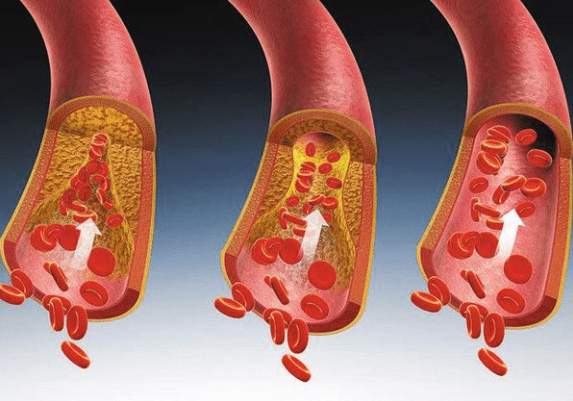 生活|32岁女子血糖从15.9到5.7,医生:常吃2种食物,或对胰岛有好处