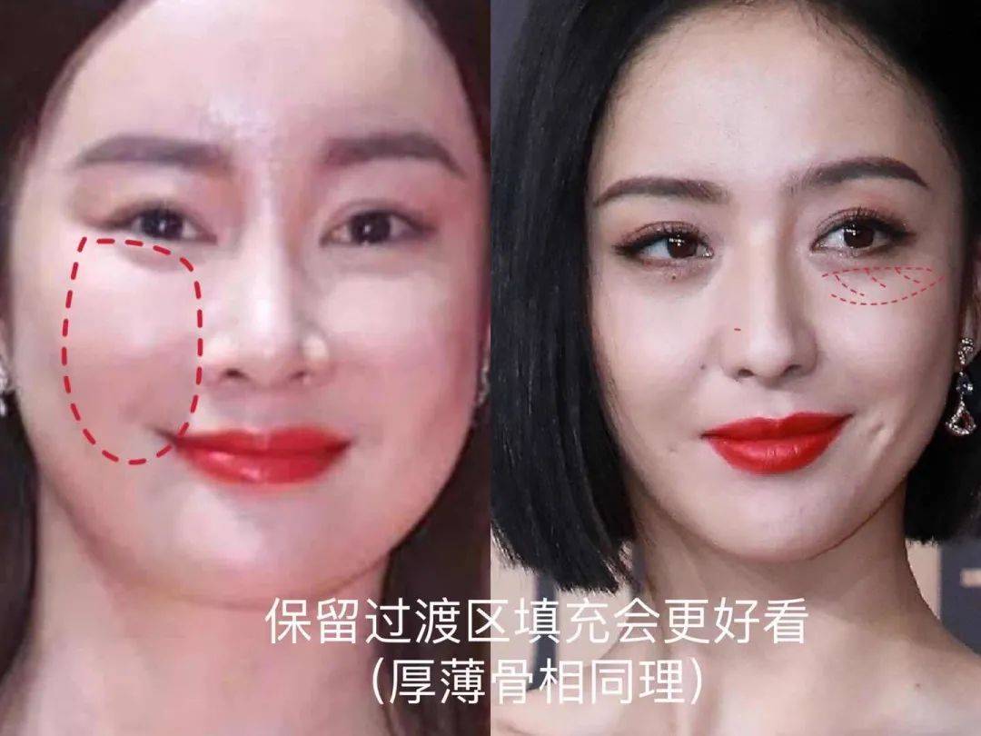 小天|救命!南韩吹炸天的大美人,这双眼皮是用菜刀do的吗…