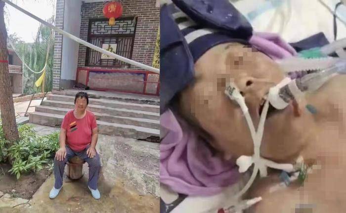 沙河市人民医院被指收红包做手术 患者术后生命垂危(图3) 沙河市人民医院被指收红包做手术 患者术后生命垂危(图3)