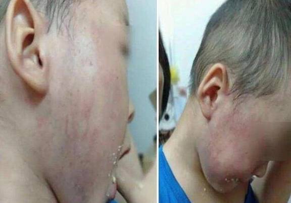 家长|不是不听话、也不是不懂规则，幼儿园老师最讨厌的其实是这种孩子